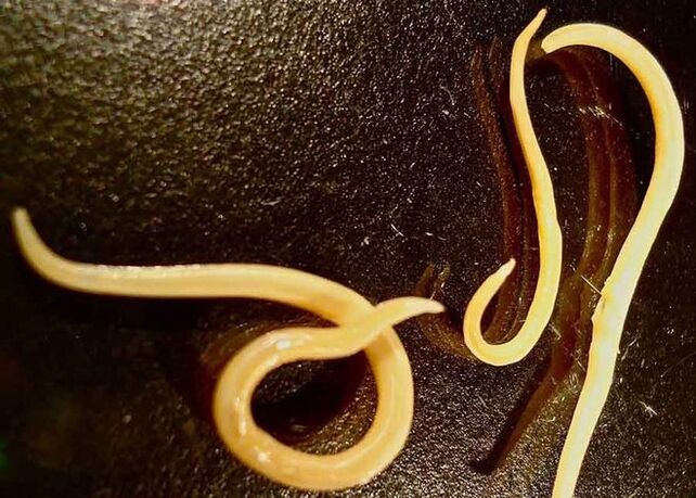 Parasites