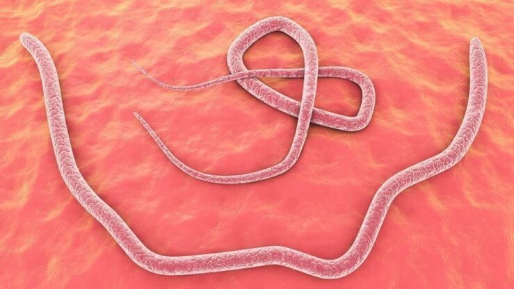 Roundworms in the human body