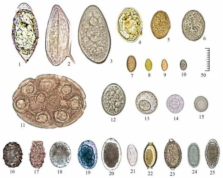 Shape and size of the eggs of various helminths