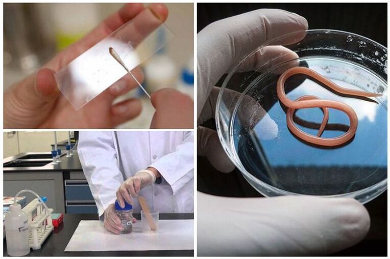 Tests for the presence of worms in the body