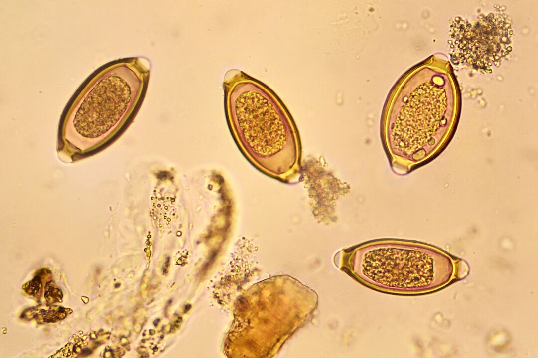 Worms in the human body