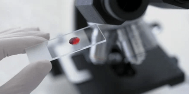 Blood sample