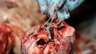 Helminthen in the heart