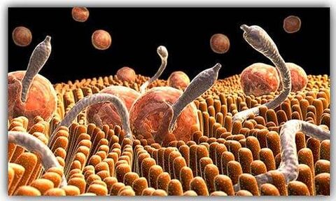 Parasites in the body