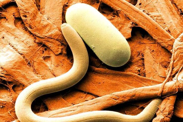 Parasites in the human body